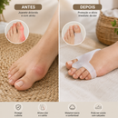 Protetor de Joanete em Gel | 2 Peças para Mais Conforto